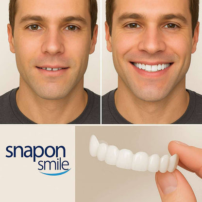 Carillas dentales SnapOn Smile™ ( Paga al recibir en casa🚚🏠)